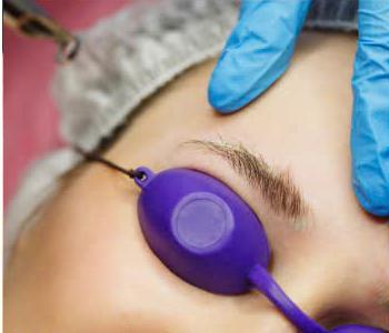 Laser 1 – Liệu Trình 1 Lần
