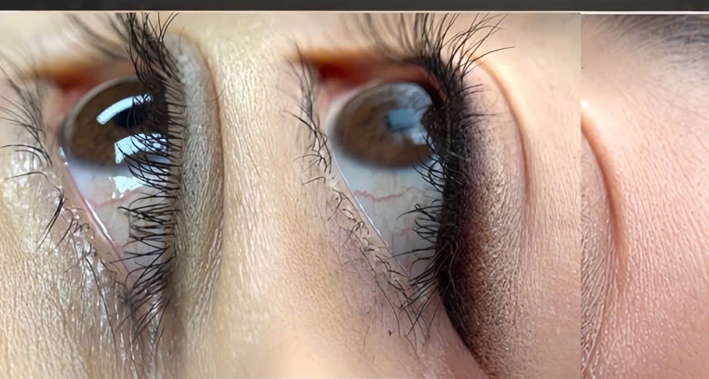 Phun Mí Mở Tròng & Eyeliner Nghệ Thuật Là Gì?