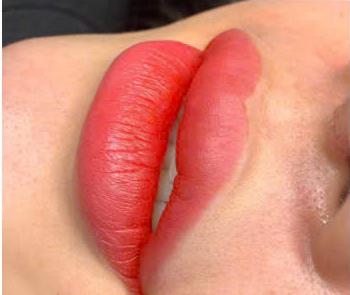 Collagenlips (Phun Môi Phủ Collagen Tự Nhiên)